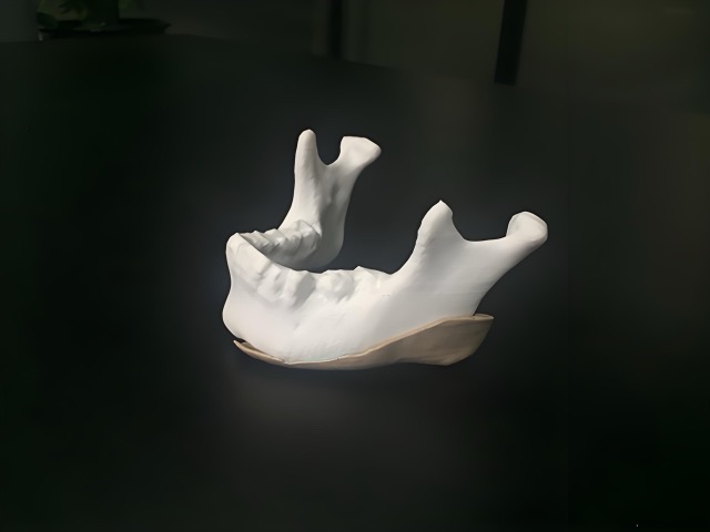 FDM Medical Model Printing